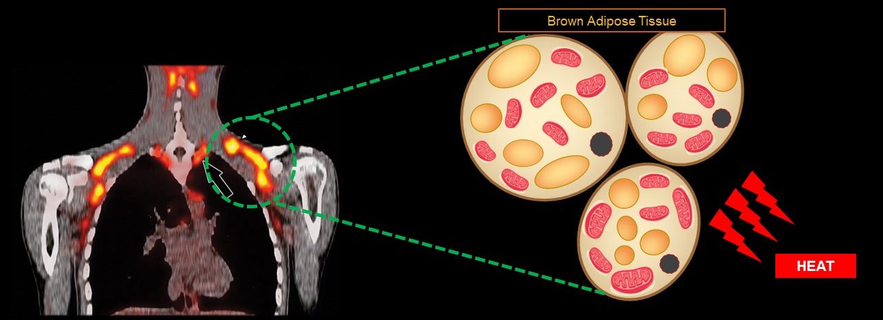 Brown Fat – Human Brown Fat Research Group Turku